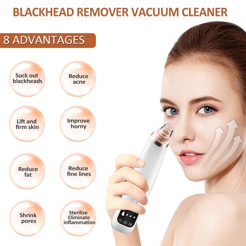 Pore cleaner blackhead remover vacuum - Premium  from eprolo - Just $24.46! Shop now at Yard Agri Supply